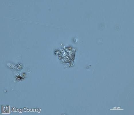 Photo of Protoperidinium brevipes